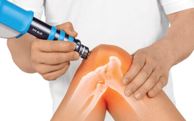 Radial Shockwave Therapy